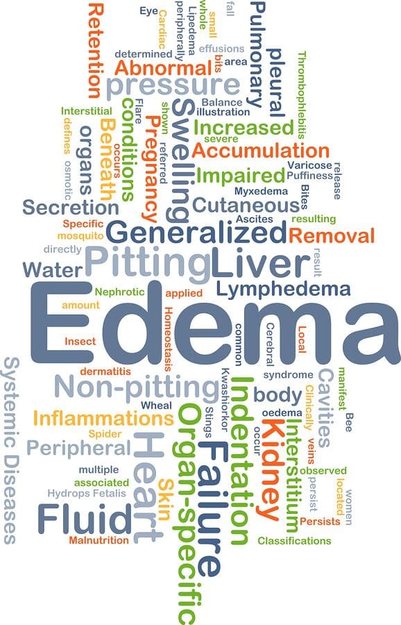 Personal Care at Home Flemington, NJ - Personal Care Helps Seniors Who Have Edema
